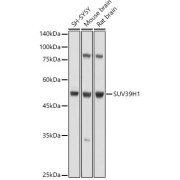 Western blot analysis of various lysates using SUV39H1 Antibody at 1/1000 dilution. Secondary antibody: HRP-conjugated Goat anti-Rabbit IgG (H+L) at 1/10000 dilution. Lysates/proteins: 25 µg per lane. Blocking buffer: 3% nonfat dry milk in TBST. Exposure time: 30s.