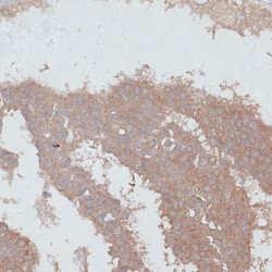 Transforming Growth Factor Beta Receptor 2 (TGFBR2) Antibody