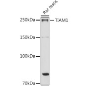 Western blot analysis of lysates from Rat testis, using TIAM1 Antibody at 1/1000 dilution. Secondary antibody: HRP-conjugated Goat anti-Rabbit IgG (H+L) at 1/10000 dilution. Lysates/proteins: 25 µg per lane. Blocking buffer: 3% nonfat dry milk in TBST. Exposure time: 30s.
