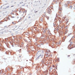 T-Cell Lymphoma Invasion And Metastasis Inducing Protein 1 (TIAM1) Antibody