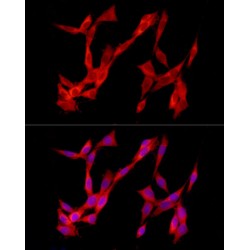 Triggering Receptor Expressed On Myeloid Cells 2 (TREM2) Antibody