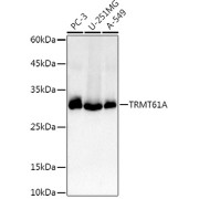 Western blot analysis of various lysates using TRMT61A Antibody at 1/1000 dilution. Secondary antibody: HRP-conjugated Goat anti-Rabbit IgG (H+L) at 1/10000 dilution. Lysates/proteins: 25 µg per lane. Blocking buffer: 3% nonfat dry milk in TBST. Exposure time: 30s.