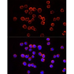 Tumor Susceptibility Gene 101 (TSG101) Antibody