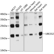 Western blot analysis of various lysates using UBE2G2 Antibody at 1/1000 dilution. Secondary antibody: HRP-conjugated Goat anti-Rabbit IgG (H+L) at 1/10000 dilution. Lysates/proteins: 25 µg per lane. Blocking buffer: 3% nonfat dry milk in TBST. Exposure time: 30s.