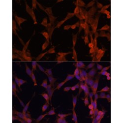 Ubiquitin-Conjugating Enzyme E2 G2 (UBE2G2) Antibody