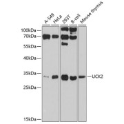 Western blot analysis of various lysates using UCK2 Antibody at 1/1000 dilution. Secondary antibody: HRP-conjugated Goat anti-Rabbit IgG (H+L) at 1/10000 dilution. Lysates/proteins: 25 µg per lane. Blocking buffer: 3% nonfat dry milk in TBST. Exposure time: 90s.