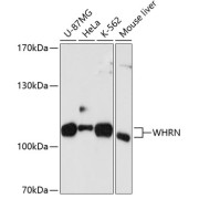 Western blot analysis of various lysates using WHRN Antibody at 1/1000 dilution. Secondary antibody: HRP-conjugated Goat anti-Rabbit IgG (H+L) at 1/10000 dilution. Lysates/proteins: 25 µg per lane. Blocking buffer: 3% nonfat dry milk in TBST. Exposure time: 90s.