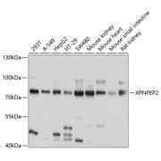 Western blot analysis of various lysates using XPNPEP2 Antibody at 1/1000 dilution. Secondary antibody: HRP-conjugated Goat anti-Rabbit IgG (H+L) at 1/10000 dilution. Lysates/proteins: 25 µg per lane. Blocking buffer: 3% nonfat dry milk in TBST. Exposure time: 1s.