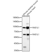 Western blot analysis of various lysates, using YME1L1 Antibody at 1/2000 dilution. Secondary antibody: HRP-conjugated Goat anti-Rabbit IgG (H+L) at 1/10000 dilution. Lysates/proteins: 25 µg per lane. Blocking buffer: 3% nonfat dry milk in TBST. Exposure time: 60s.