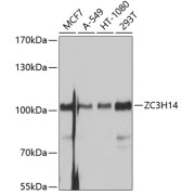 Western blot analysis of various lysates using ZC3H14 Antibody at 1/1000 dilution. Secondary antibody: HRP-conjugated Goat anti-Rabbit IgG (H+L) at 1/10000 dilution. Lysates/proteins: 25 µg per lane. Blocking buffer: 3% nonfat dry milk in TBST. Exposure time: 1s.