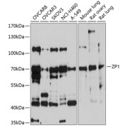 Western blot analysis of various lysates using ZP1 Antibody at 1/1000 dilution. Secondary antibody: HRP-conjugated Goat anti-Rabbit IgG (H+L) at 1/10000 dilution. Lysates/proteins: 25 µg per lane. Blocking buffer: 3% nonfat dry milk in TBST. Exposure time: 90s.