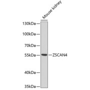 Western blot analysis of lysates from mouse kidney, using ZSCAN4C Antibody at 1/1000 dilution. Secondary antibody: HRP-conjugated Goat anti-Rabbit IgG (H+L) at 1/10000 dilution. Lysates/proteins: 25 µg per lane. Blocking buffer: 3% nonfat dry milk in TBST. Exposure time: 90s.