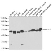 Western blot analysis of various lysates using EEF1A2 Antibody at 1/1000 dilution. Secondary antibody: HRP-conjugated Goat anti-Rabbit IgG (H+L) at 1/10000 dilution. Lysates/proteins: 25 µg per lane. Blocking buffer: 3% nonfat dry milk in TBST. Exposure time: 90s.