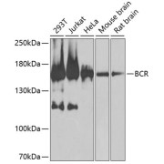 Western blot analysis of various lysates using BCR Antibody at 1/1000 dilution. Secondary antibody: HRP-conjugated Goat anti-Rabbit IgG (H+L) at 1/10000 dilution. Lysates/proteins: 25 µg per lane. Blocking buffer: 3% nonfat dry milk in TBST. Exposure time: 30s.