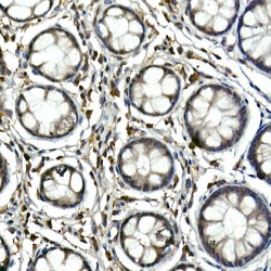 Tyrosine-Protein Kinase Tec (TEC) Antibody