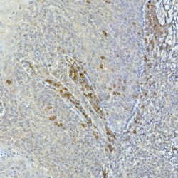 Tyrosine-Protein Kinase Tec (TEC) Antibody