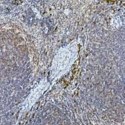 Tyrosine-Protein Kinase Tec (TEC) Antibody