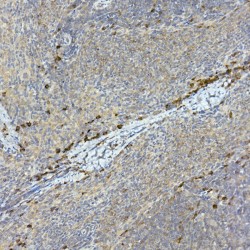 Tyrosine-Protein Kinase Tec (TEC) Antibody