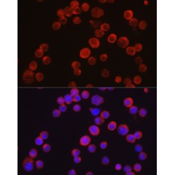 Tyrosine-Protein Kinase Tec (TEC) Antibody