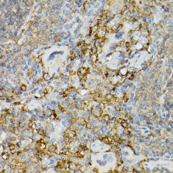 Mast/Stem Cell Growth Factor Receptor Kit (KIT) Antibody