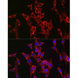 Fibroblast Growth Factor Receptor 3 (FGFR3) Antibody