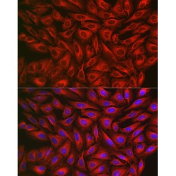 Fibroblast Growth Factor Receptor 3 (FGFR3) Antibody