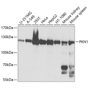 Western blot analysis of various lysates using PKN1 Antibody at 1/1000 dilution. Secondary antibody: HRP-conjugated Goat anti-Rabbit IgG (H+L) at 1/10000 dilution. Lysates/proteins: 25 µg per lane. Blocking buffer: 3% nonfat dry milk in TBST. Exposure time: 5s.