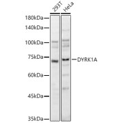 Western blot analysis of various lysates using DYRK1A Antibody at 1/1000 dilution. Secondary antibody: HRP-conjugated Goat anti-Rabbit IgG (H+L) at 1/10000 dilution. Lysates/proteins: 25 µg per lane. Blocking buffer: 3% nonfat dry milk in TBST. Exposure time: 10s.