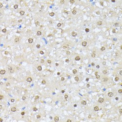 Casein Kinase II Subunit Alpha (CSNK2A1) Antibody