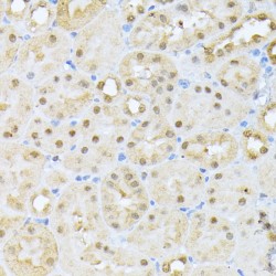 Casein Kinase II Subunit Alpha (CSNK2A1) Antibody