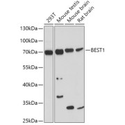 Western blot analysis of various lysates using BEST1 Antibody at 1/1000 dilution. Secondary antibody: HRP-conjugated Goat anti-Rabbit IgG (H+L) at 1/10000 dilution. Lysates/proteins: 25 µg per lane. Blocking buffer: 3% nonfat dry milk in TBST. Exposure time: 90s.