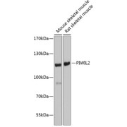 Western blot analysis of various lysates using PIWIL2 Antibody at 1/1000 dilution. Secondary antibody: HRP-conjugated Goat anti-Rabbit IgG (H+L) at 1/10000 dilution. Lysates/proteins: 25 µg per lane. Blocking buffer: 3% nonfat dry milk in TBST. Exposure time: 5s.
