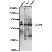 Western blot analysis of various lysates using COL4A5 Antibody at 1/1000 dilution. Secondary antibody: HRP-conjugated Goat anti-Rabbit IgG (H+L) at 1/10000 dilution. Lysates/proteins: 25 µg per lane. Blocking buffer: 3% nonfat dry milk in TBST. Exposure time: 5s.
