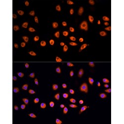 Epidermal Growth Factor Receptor Pathway Substrate 15 (EPS15) Antibody