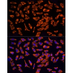 Epidermal Growth Factor Receptor Pathway Substrate 15 (EPS15) Antibody