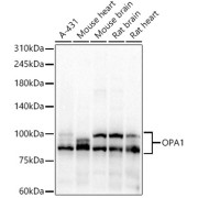 Western blot analysis of various lysates, using OPA1 Antibody at 1/7000 dilution. Secondary antibody: HRP-conjugated Goat anti-Rabbit IgG (H+L) at 1/10000 dilution. Lysates/proteins: 25 µg per lane. Blocking buffer: 3% nonfat dry milk in TBST. Exposure time: 30s.