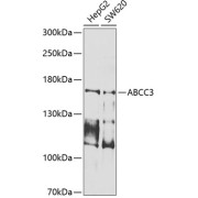 Western blot analysis of various lysates using ABCC3 Antibody at 1/1000 dilution. Secondary antibody: HRP-conjugated Goat anti-Rabbit IgG (H+L) at 1/10000 dilution. Lysates/proteins: 25 µg per lane. Blocking buffer: 3% nonfat dry milk in TBST. Exposure time: 1s.