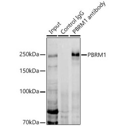 Protein Polybromo-1 (PBRM1) Antibody