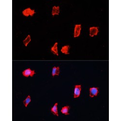 Cyclic ADP-Ribose Hydrolase 2 (BST1) Antibody