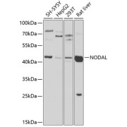 Western blot analysis of various lysates using NODAL Antibody at 1/1000 dilution. Secondary antibody: HRP-conjugated Goat anti-Rabbit IgG (H+L) at 1/10000 dilution. Lysates/proteins: 25 µg per lane. Blocking buffer: 3% nonfat dry milk in TBST. Exposure time: 30s.
