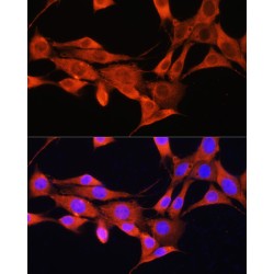 Aminomethyltransferase, Mitochondrial (AMT) Antibody
