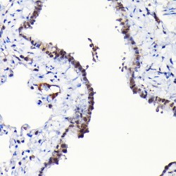 Regulator of G Protein Signaling 14 (RGS14) Antibody