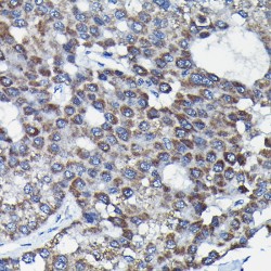 Regulator of G Protein Signaling 14 (RGS14) Antibody