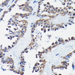 Regulator of G Protein Signaling 14 (RGS14) Antibody