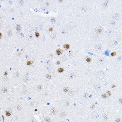 Ribonuclease P And MRP Subunit P25 (RPP25) Antibody