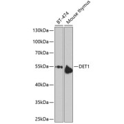 Western blot analysis of various lysates using DET1 Antibody at 1/1000 dilution. Secondary antibody: HRP-conjugated Goat anti-Rabbit IgG (H+L) at 1/10000 dilution. Lysates/proteins: 25 µg per lane. Blocking buffer: 3% nonfat dry milk in TBST. Exposure time: 10s.