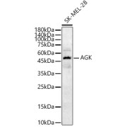 Western blot analysis of lysates from SK-MEL-28 cells, using AGK Antibody at 1/1000 dilution. Secondary antibody: HRP-conjugated Goat anti-Rabbit IgG (H+L) at 1/10000 dilution. Lysates/proteins: 25 µg per lane. Blocking buffer: 3% nonfat dry milk in TBST. Exposure time: 30s.