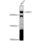 Nuclear Receptor Binding SET Domain Protein 1 (NSD1) Antibody