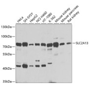 Western blot analysis of various lysates using SLC2A13 Antibody at 1/1000 dilution. Secondary antibody: HRP-conjugated Goat anti-Rabbit IgG (H+L) at 1/10000 dilution. Lysates/proteins: 25 µg per lane. Blocking buffer: 3% nonfat dry milk in TBST. Exposure time: 1s.