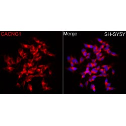 Voltage-Dependent Calcium Channel Gamma-1 Subunit (CACNG1) Antibody